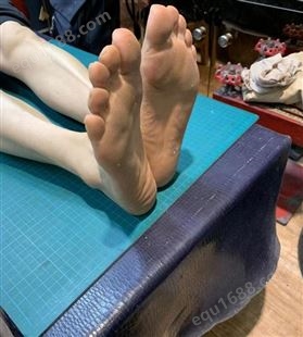 巴力丁矫形鞋垫 .一对一个性化定制 善长解决复杂畸形脚型